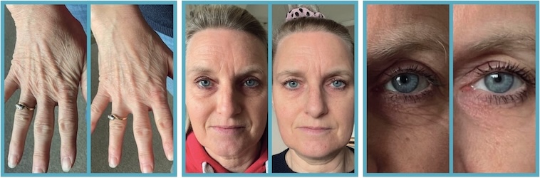 Les Resultats Forever Marine Collagen - 1 sur 2