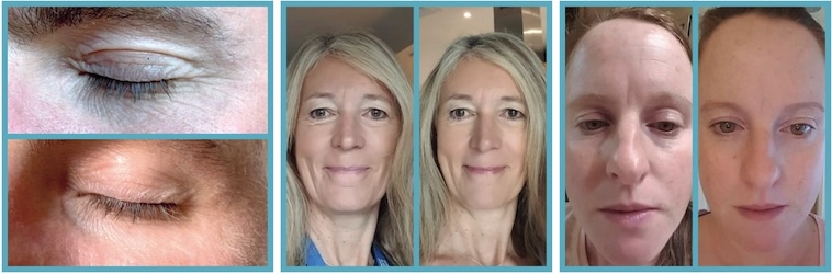 Les Resultats Forever Marine Collagen - 2 sur 2